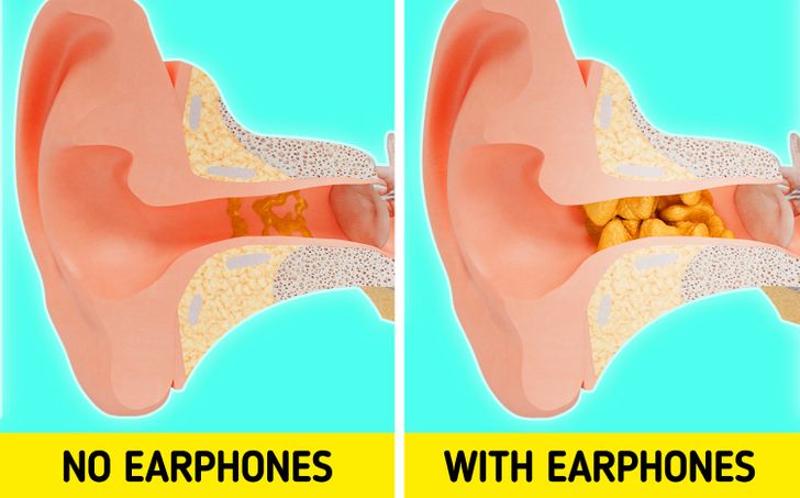 How to Reduce Ear Pain from Earbuds: