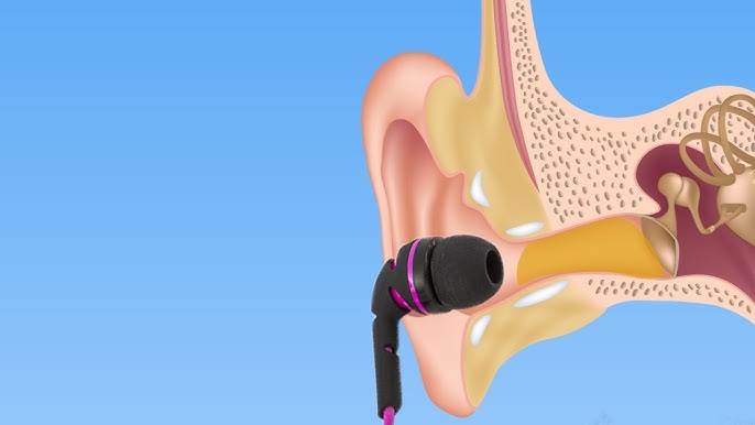 How to Reduce Ear Pain from Earbuds: